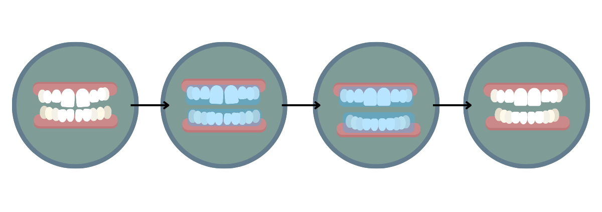 the Invisalign process - Boroughbridge Dental Practice - Ripon