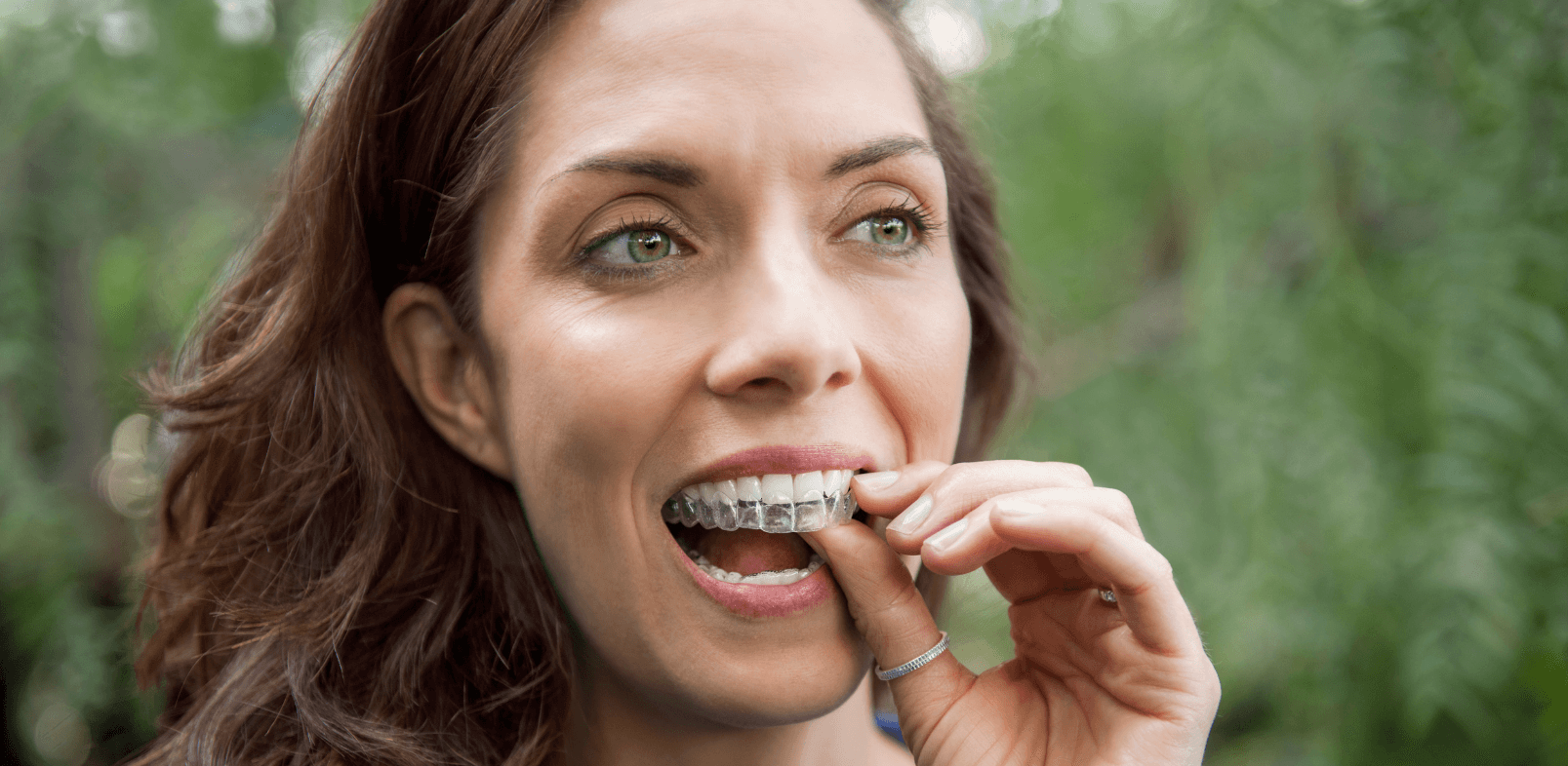Lady placing Invisalign aligners into her mouth