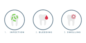 dental emergency examples graphics - Ripon dental practice