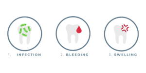 Dental Emergency - Boroughbridge Dental Practice - Ripon