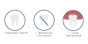 Causes of sensitive teeth - Boroughbridge Dental Practice - Ripon