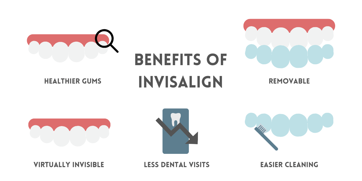 benefits of Invisalign - Boroughbridge dental practice - ripon