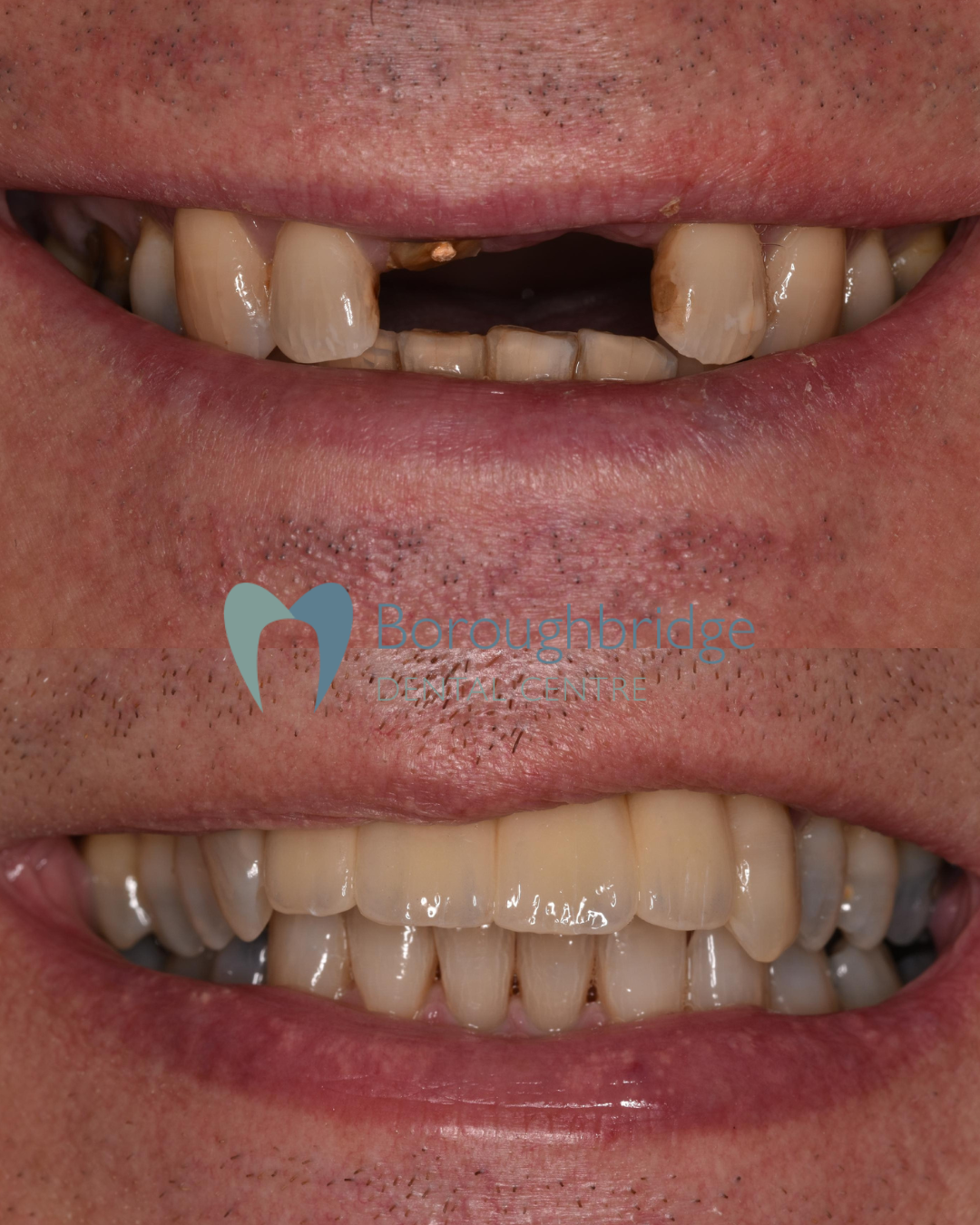 Boroughbridge Dental Practice | Dental Practice Ripon | Dentist North Yorkshire