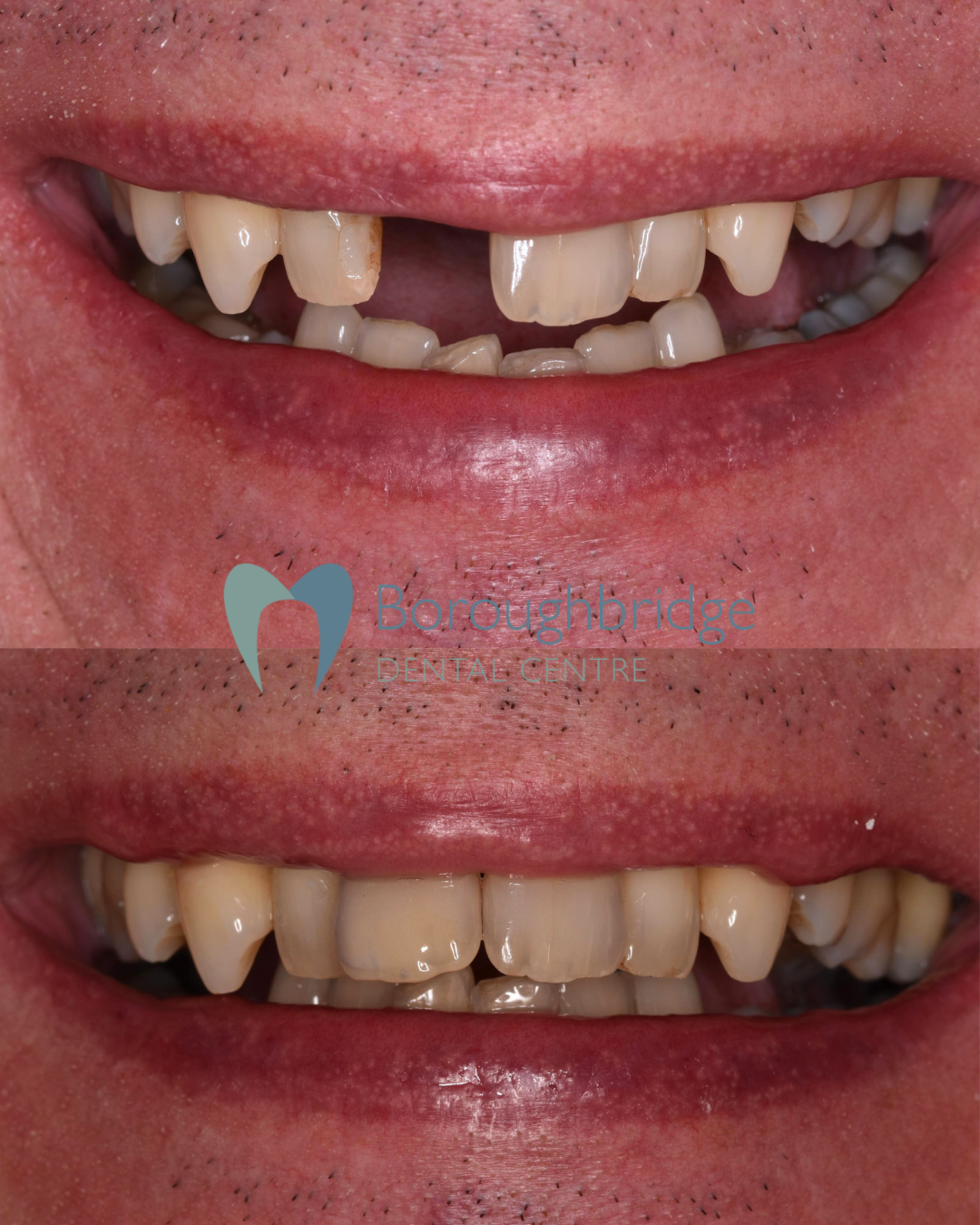 Boroughbridge Dental Practice | Dental Practice Ripon | Dentist North Yorkshire