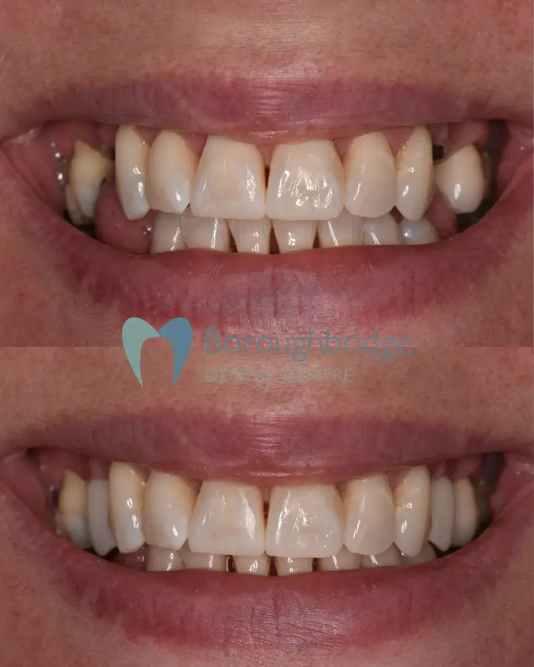 Boroughbridge Dental Practice | Dental Practice Ripon | Dentist North Yorkshire