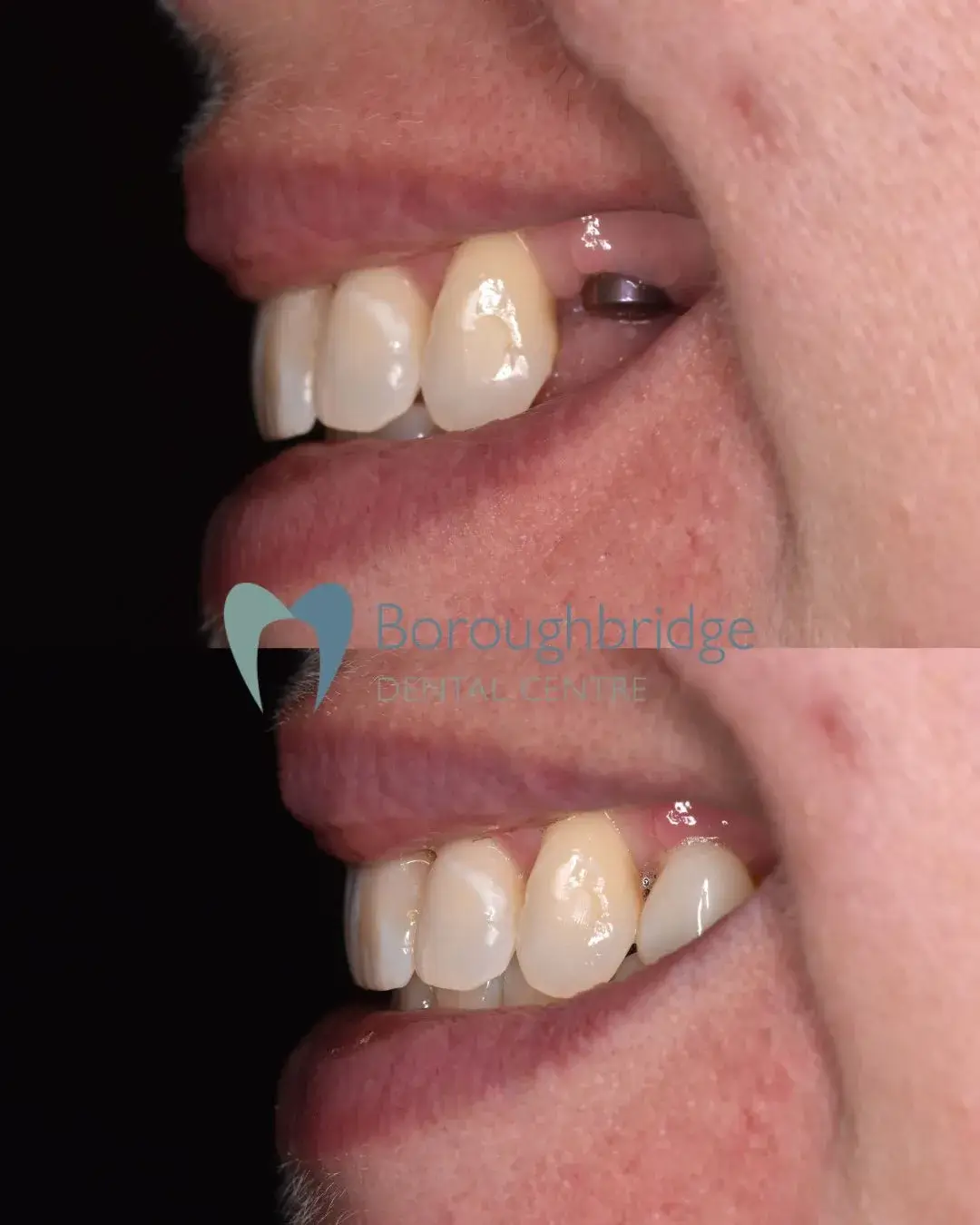 Boroughbridge Dental Practice | Dental Practice Ripon | Dentist North Yorkshire