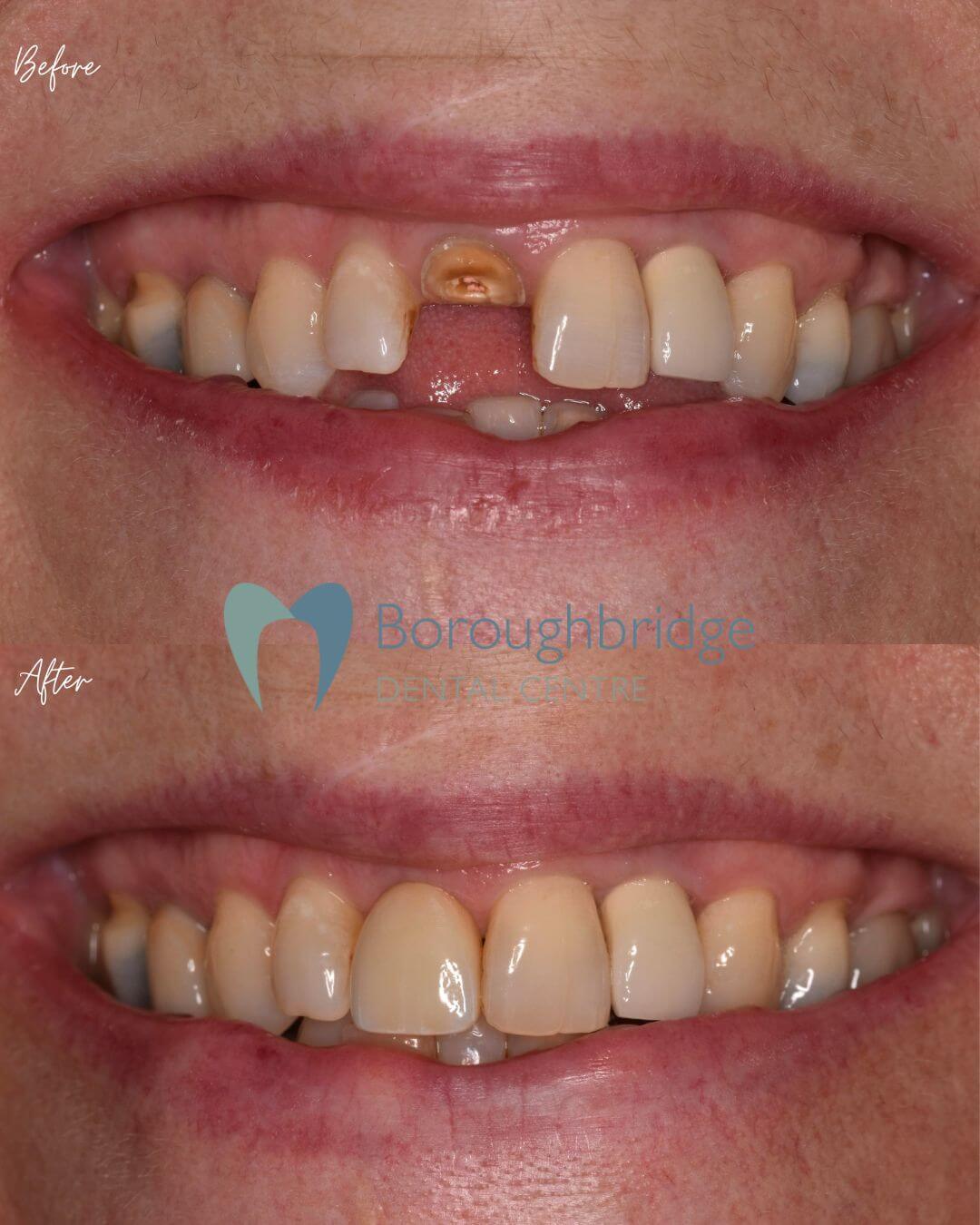 Boroughbridge Dental Practice | Dental Practice Ripon | Dentist North Yorkshire