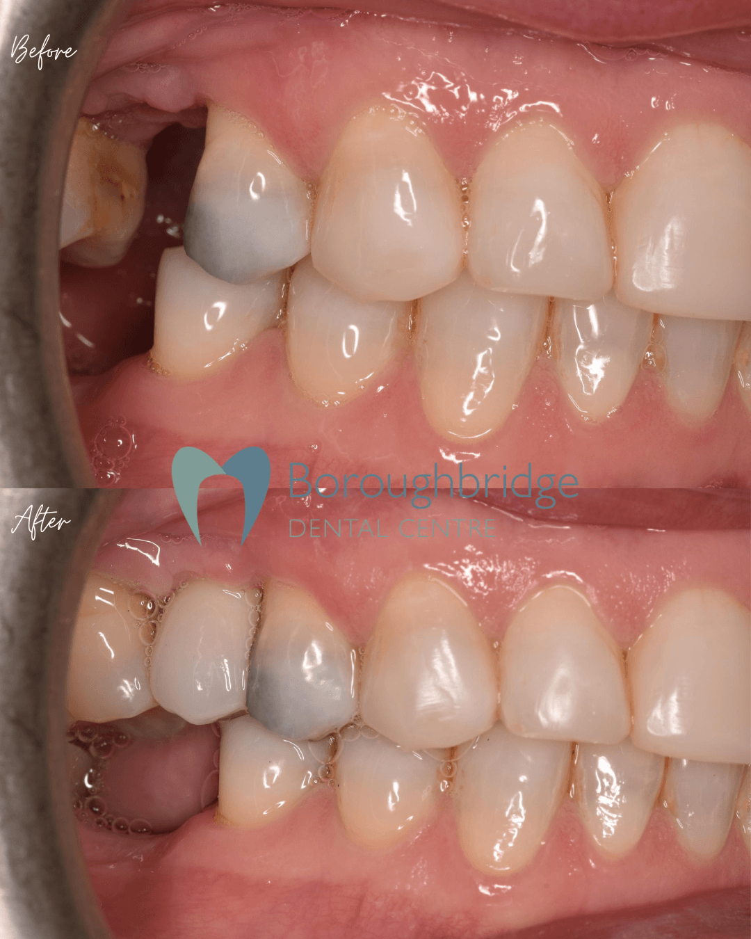 Boroughbridge Dental Practice | Dental Practice Ripon | Dentist North Yorkshire