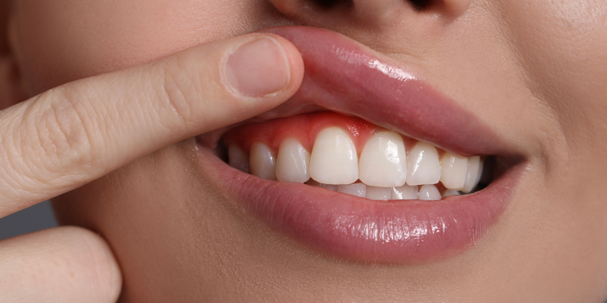 gums and links to overal health banner